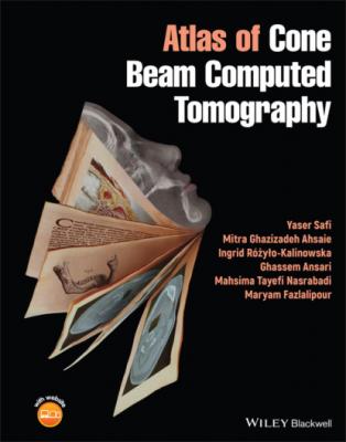 Atlas of Cone Beam Computed Tomography - Ghassem Ansari 