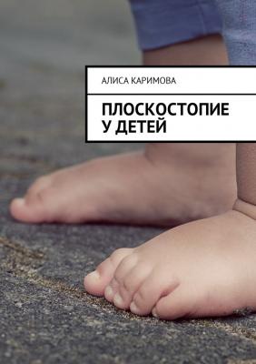 Плоскостопие у детей - Алиса Каримова 