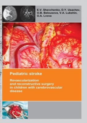 Pediatric stroke. Revascularization and reconstructive surgery in children with cerebrovascular disease - E. V. Shevchenko 
