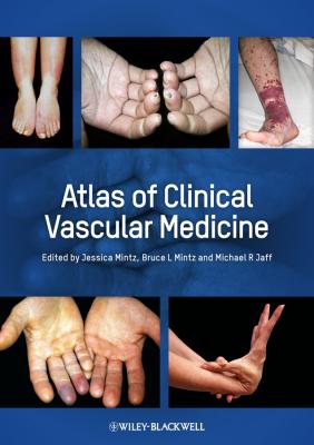 Atlas of Clinical Vascular Medicine - Jessica  Mintz 