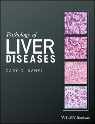 Pathology of Liver Diseases - Gary Kanel C. 