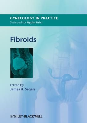Fibroids - James Segars H. 