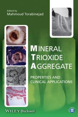 Mineral Trioxide Aggregate. Properties and Clinical Applications - Mahmoud  Torabinejad 