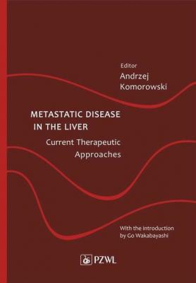 Metastatic Disease in the Liver - Current Therapeutic Approaches - Группа авторов 