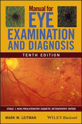 Manual for Eye Examination and Diagnosis - Mark W. Leitman 