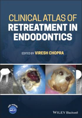 Clinical Atlas of Retreatment in Endodontics - Группа авторов 