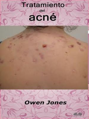 Tratamiento Del Acné - Owen Jones 