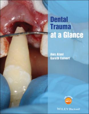Dental Trauma at a Glance - Aws Alani 